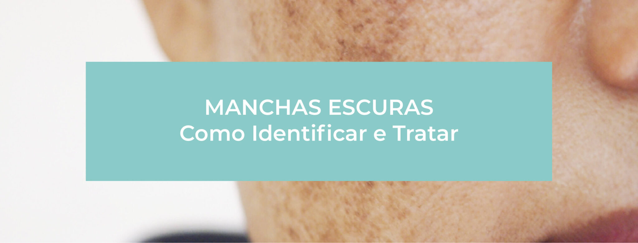 Manchas escuras na pele do rosto: como tratar?