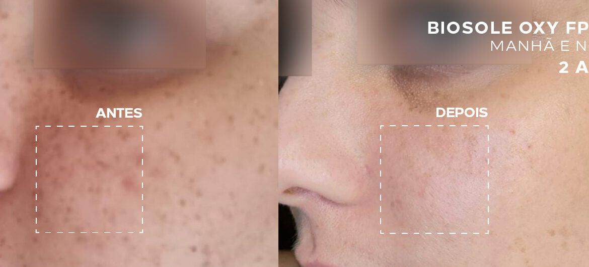 O que significa “clareia 2x mais”? Entenda o impacto dos protetores solares na pele!