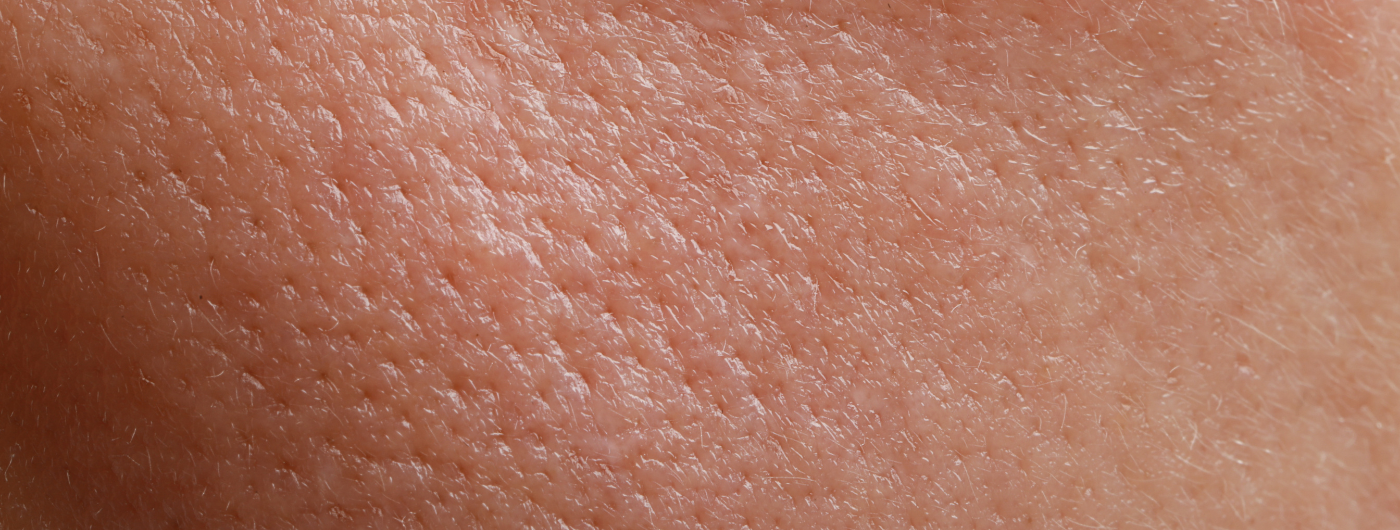 O que causa oleosidade no rosto? 5 fatores que você não imagina