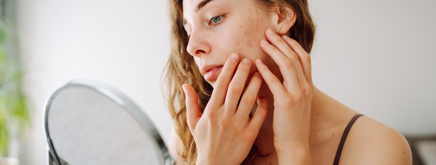 Como saber meu tipo de pele?