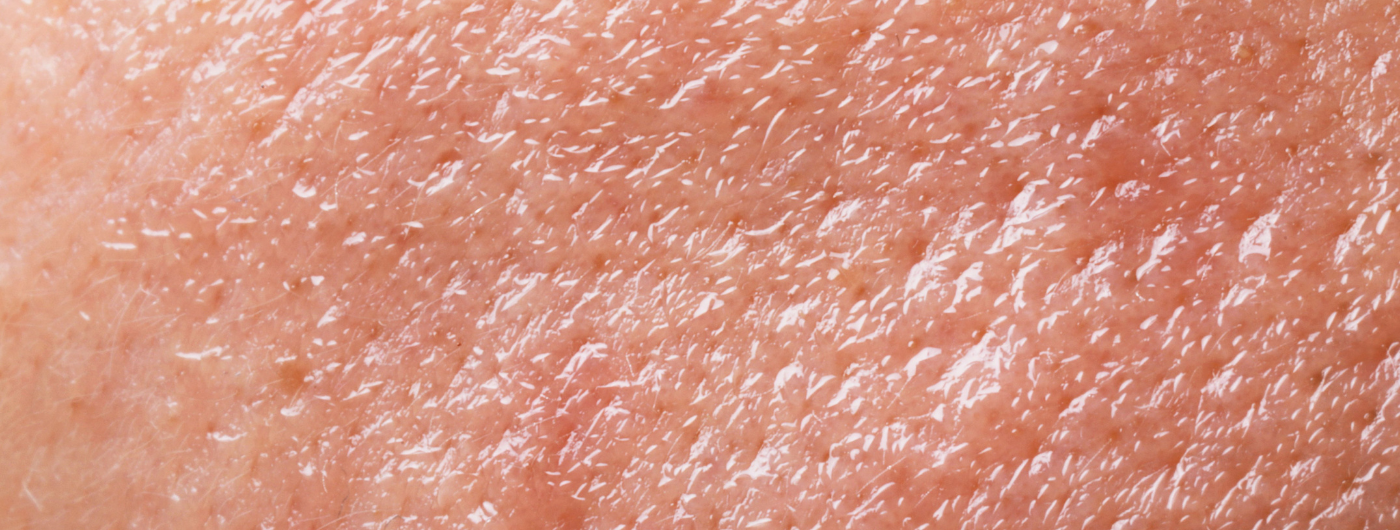 Qual sérum é mais eficaz para tratar melasma em peles oleosas?