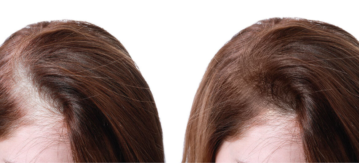 Melhor shampoo para queda de cabelo: Como escolher?