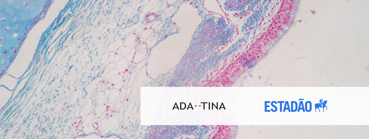 O Estadão aponta Epigenetic 61 Concentrate Clarify na tendência de rejuvenescimento natural