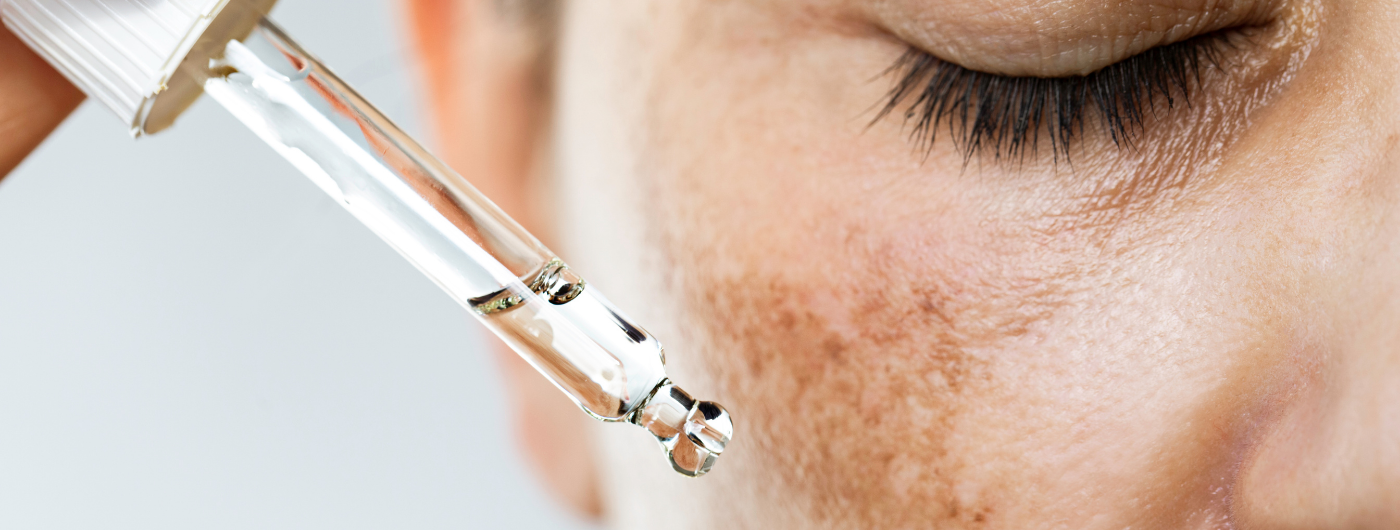 Qual é o melhor sérum para melasma e manchas resistentes?