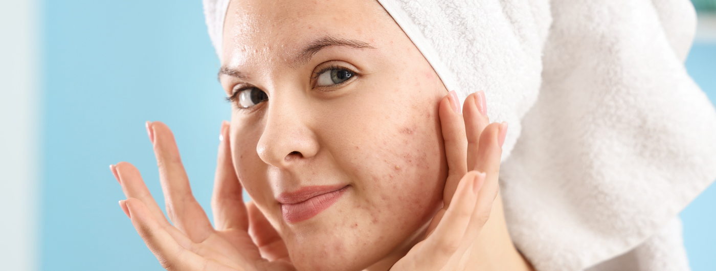 Rotina de skincare completa para pele com manchas