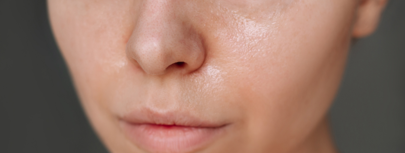 O que causa o excesso de oleosidade na pele do rosto?