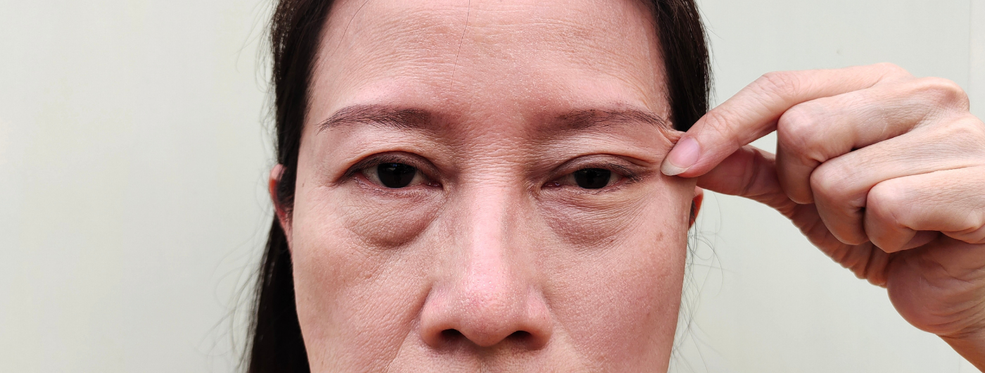 Flacidez facial: o que causa e como prevenir com dermocosméticos