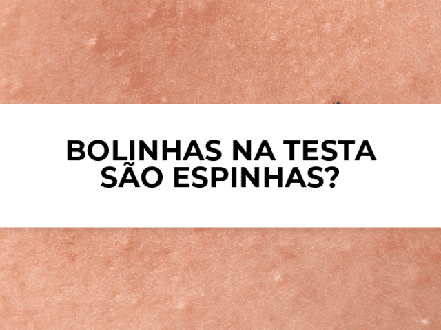 Bolinhas na testa são espinhas?