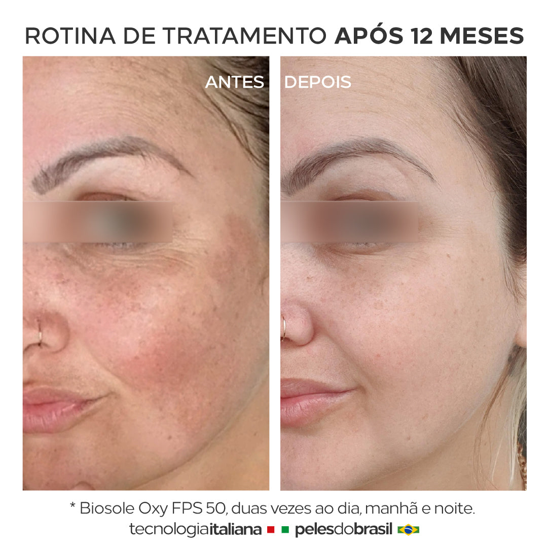 Kit 2 Un Protetor Solar 12HS Clareador Peles com Manchas e Melasma Biosole Oxy FPS 50