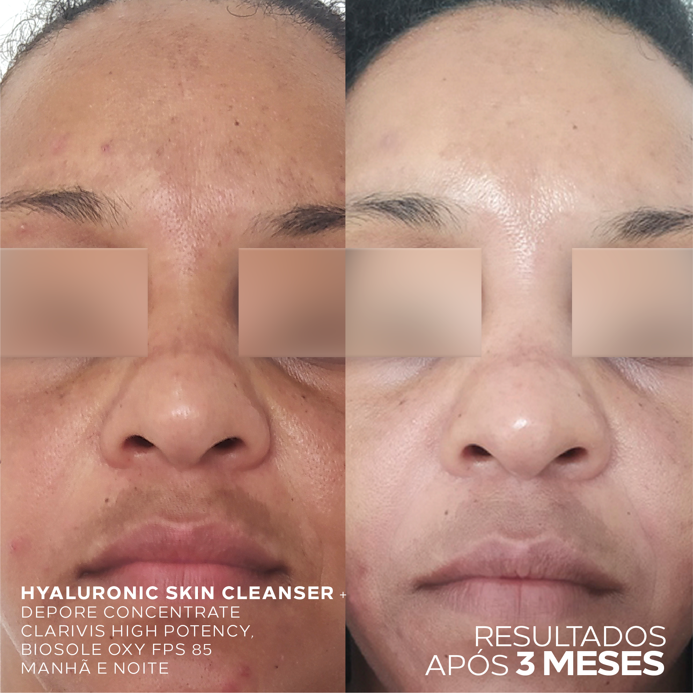 Super Fluido de Limpeza  – Hyaluronic Skin Cleanser