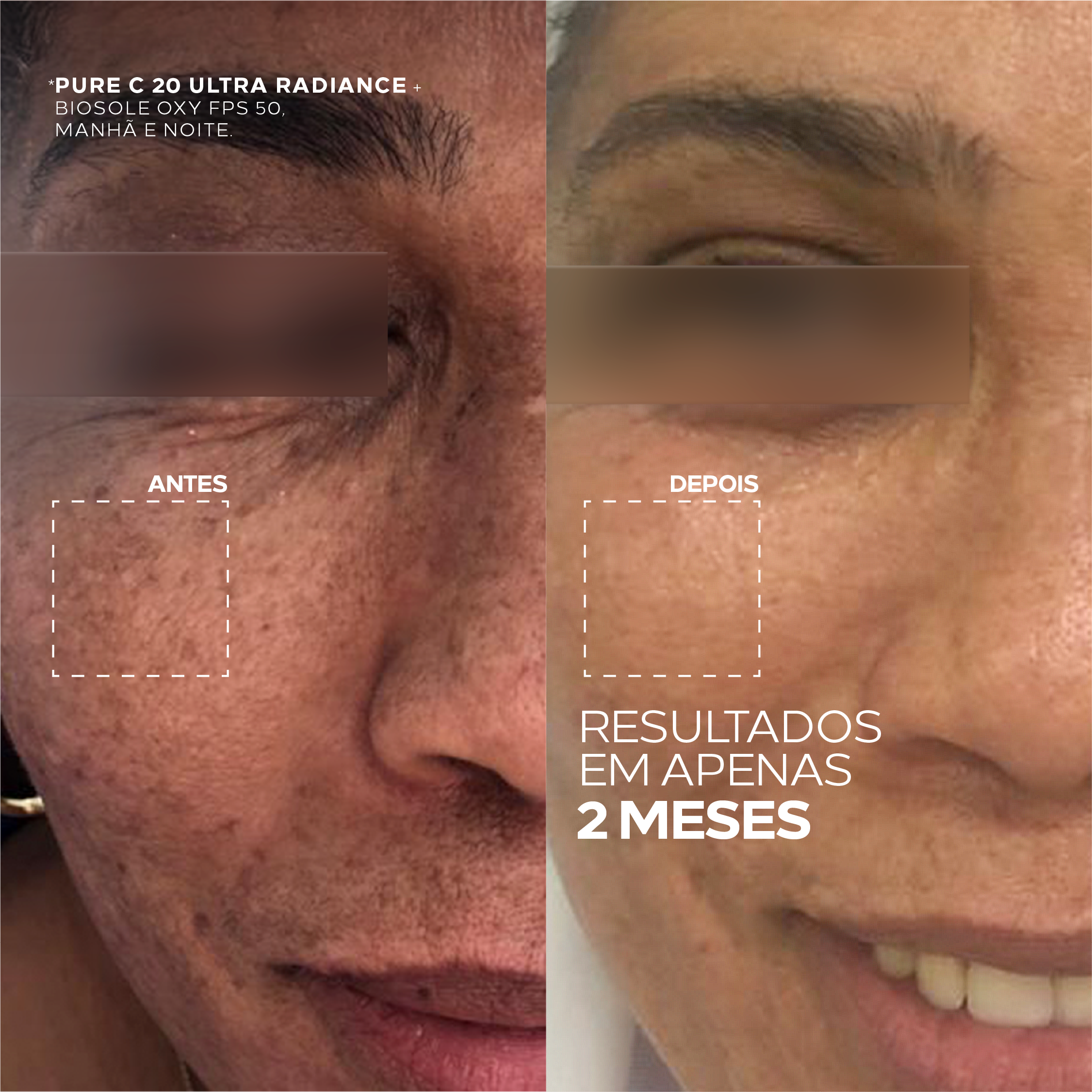 Creme Clareador Anti-idade com Vitamina C Pura e Textura Mousse – Pure C 20 Ultra Radiance