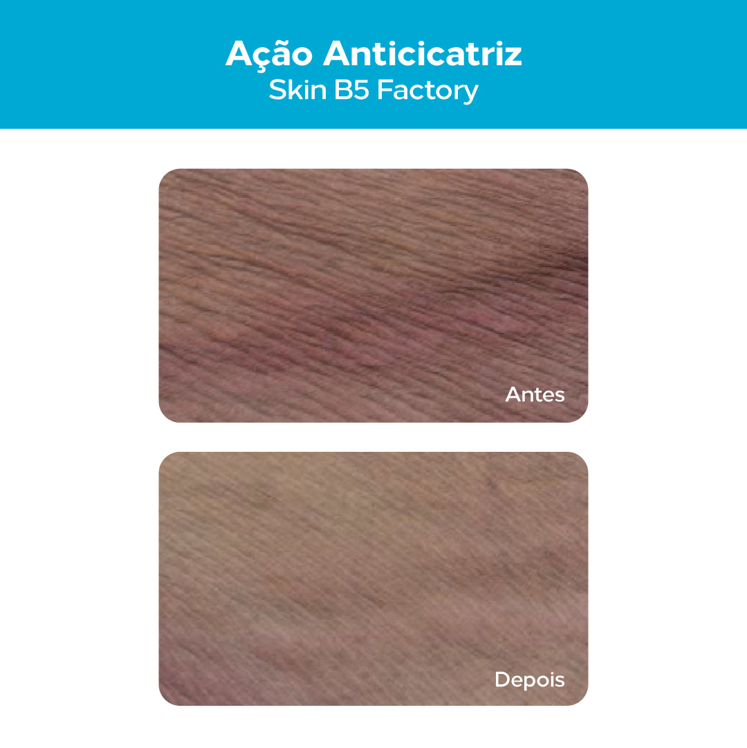 Comparação visual antes e depois da aparência de cicatriz com a tecnologia Skin B5 Factory do sérum CICA B12+.