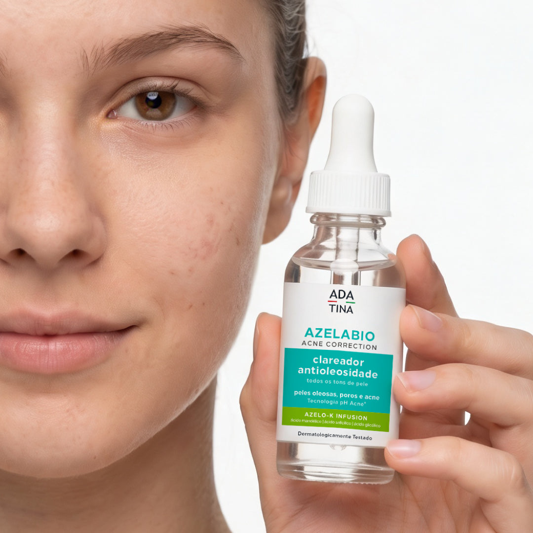 Aplicação do sérum Azelabio em pele com acne e manchas.