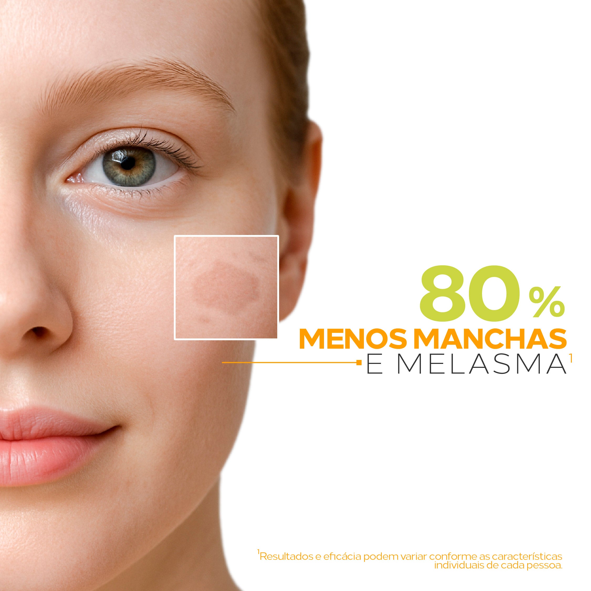 Biosole TX FPS 80 reduz 80% as manchas e melasma, com ácido tranexâmico, niacinamida e Difendiox.