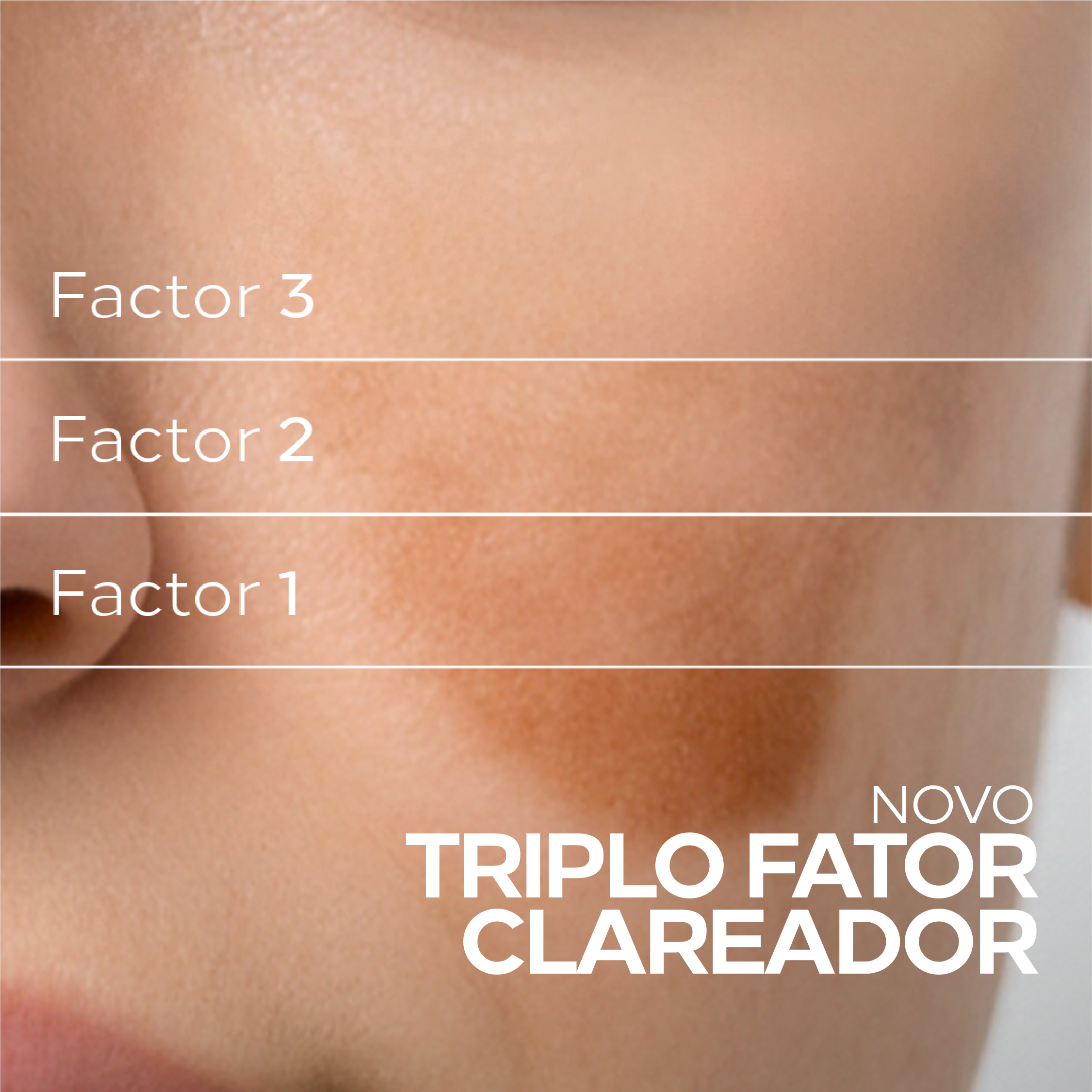 Resultado do fator clareador do protetor solar Biosole C FPS 50 na pele.