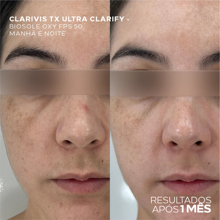 Kit Melasma Completo 4 Passos – Limpeza, Antioxidante, Hidratação e Proteção Solar