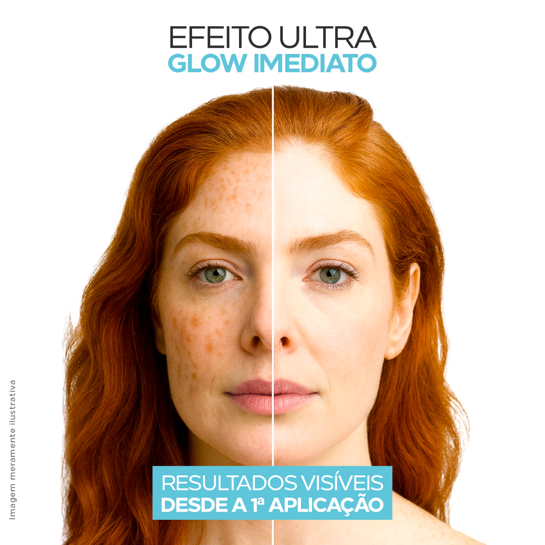 Antes e depois do uso de Oxygenials Ultra Glow Clareante, resultados visíveis desde a primeira aplicação.